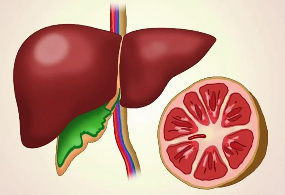 Fatty liver